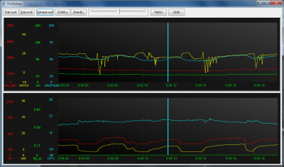 Spark advance error when engine warm (LPG)